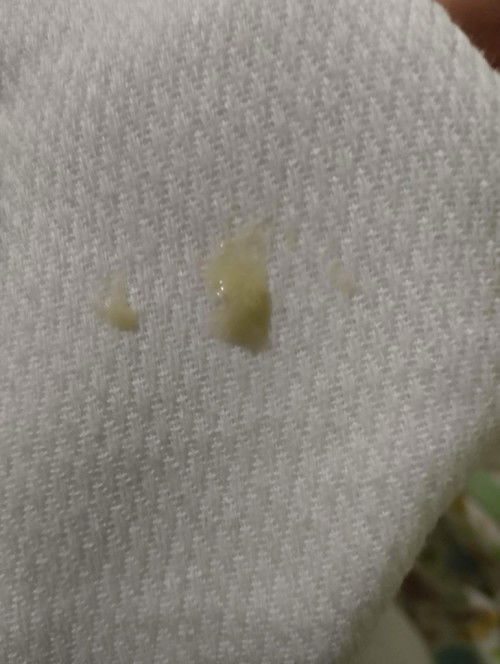 Baby:
Pag Ganto Napo Ba Ang Sipon 
May Chance na Malapit nang Mawala