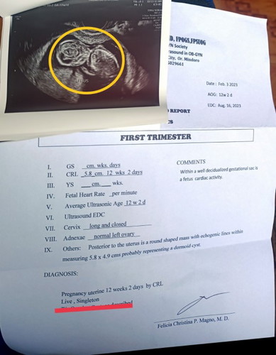 Ovarian cyst while pregnant