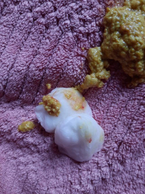 Feses bayi 1 bulan ada bercak darah