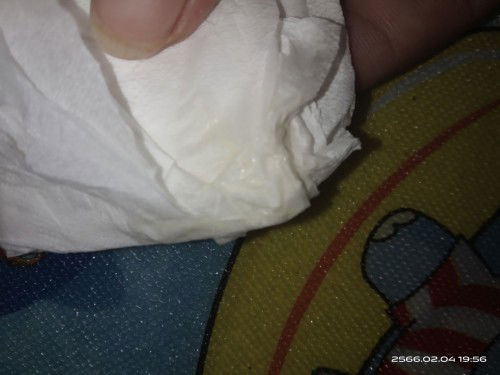 ตกขาวหรือมูกใสคะ