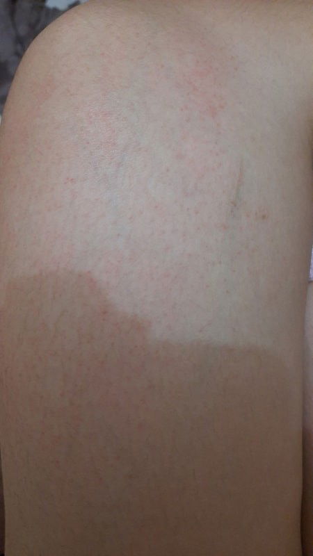 Bercak merah dikehamilan menuju 15 minggu