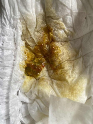 การขับถ่ายของลูก