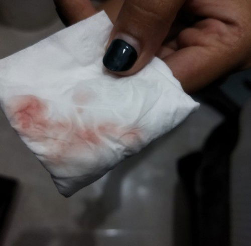 Keluar darah dr vagina