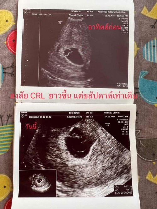 ตัวอ่อนยาวขึ้น แต่สัปดาห์เท่าเดิม