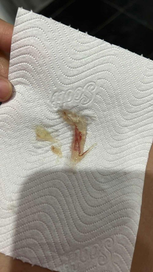 กำหนดคลอด 14 กุมภาพันธุ์ วันนี้มีมูกเลือด