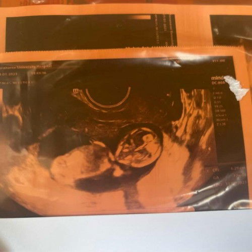 17 w เจ้าตัวน้อยของแม่