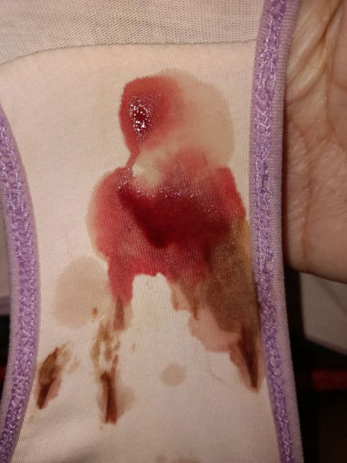 Pasintabi lang po sa mga kumakain dyan.
Tanung lang po