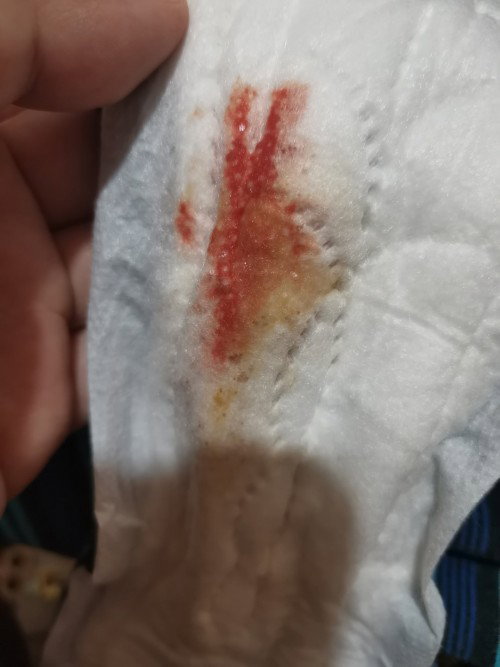 Discharge after giving birth