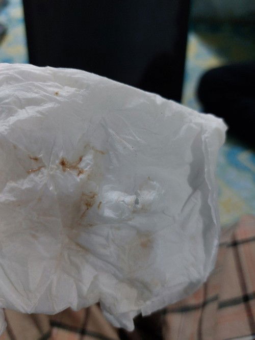 Flek coklat berhari hari