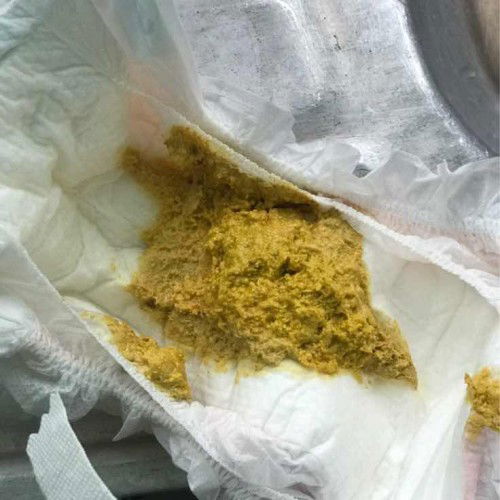 Confius nak kenal jenis najis baby