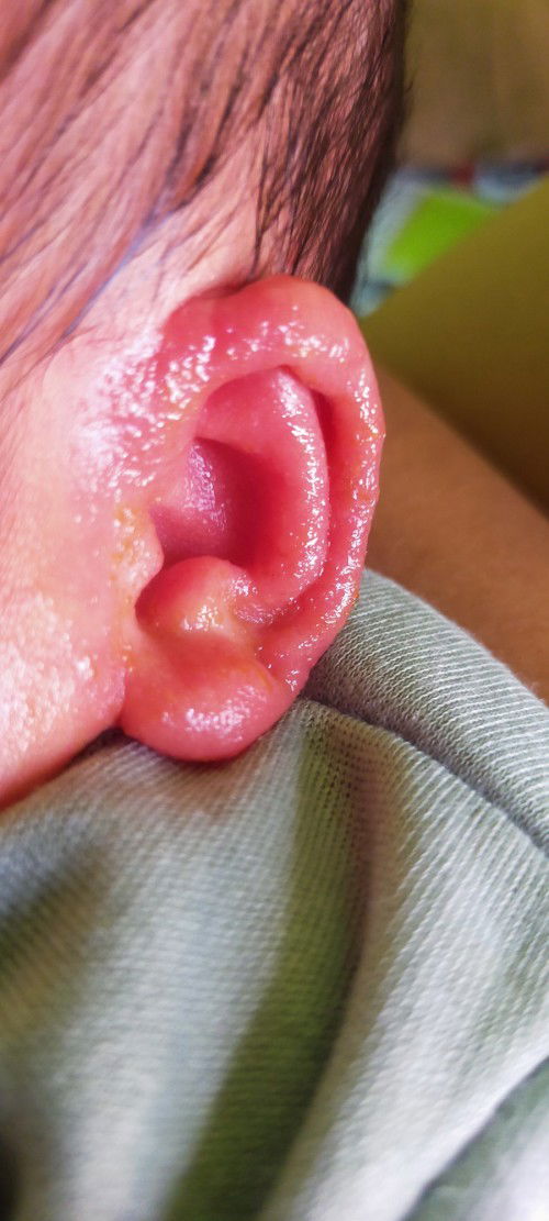 Bantu jawab dong bun