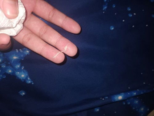 เจ็บท้องน้อย