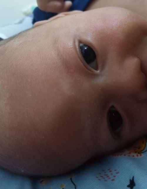 wajah merah habis mandi