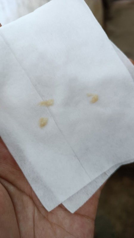 มันคืออะไรค่ะ🥺