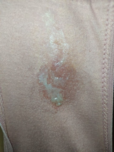 Egg white discharge