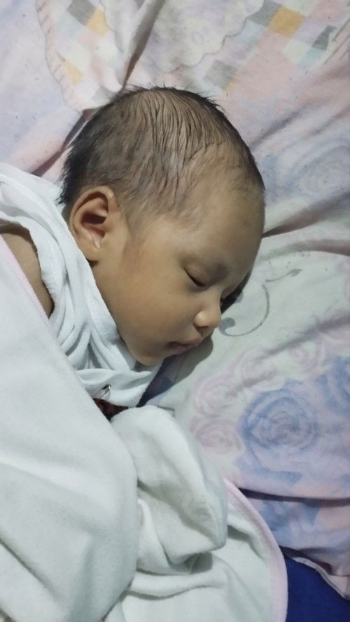 Ayus lang po ba yung shape ng ul ng baby namin 24days old palang po sya