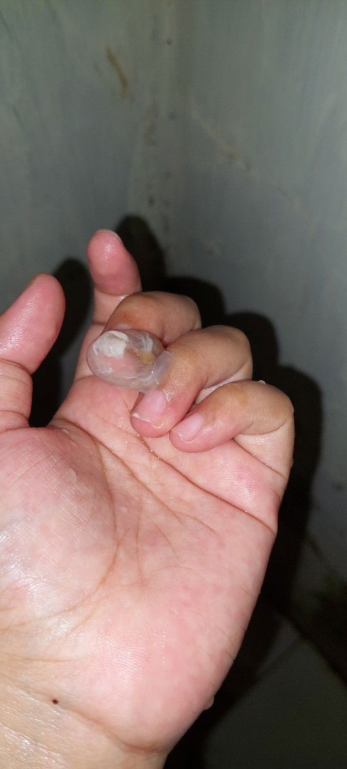 Ciri ciri pembukaan melahirkan