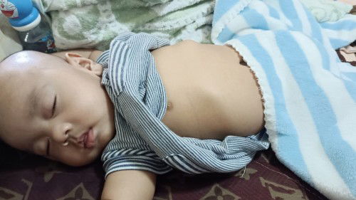 เด็ก4เดือน ไอ มีน้ำมูก