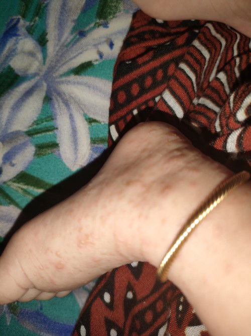 Ada yang mengalami seperti ini?