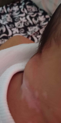 Tanong lang po kung ano ito nasa leeg ng baby ko,una kce namumula lang siya parang pilas ngayon Yan