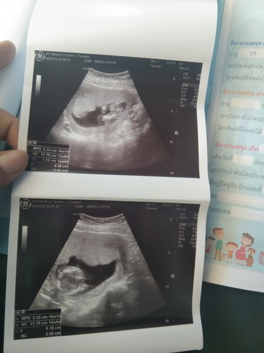 แม่ๆคะแบบนี้ดูยังไงคะ