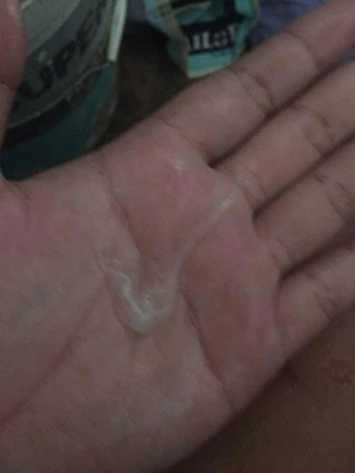 ท้องได้35+6สัปดาห์มีมูกใสต้องไปหาหมอไหมคะ