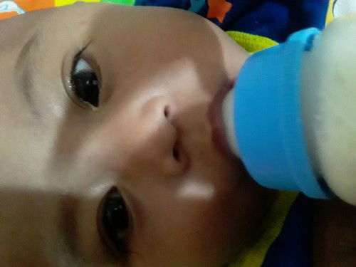 Mata anakku keluar kotoran terus