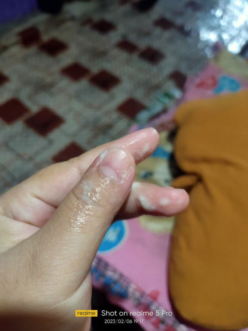 Mau tanya bun barangkali ada yang tau, ini keputihan yah?? Soalnya saya sering ngerasain rembesan