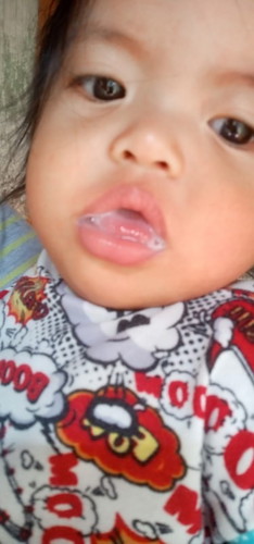 Bkit ayw Kumain at dumede ni baby.Iyak pa sya ng iyak at lging nka lawit dila nya prang naanghangan.