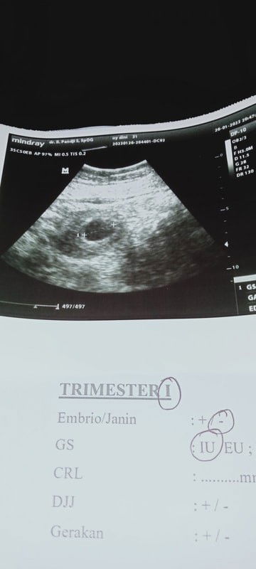 Hasil USG baru trlihat kantong saja d usia 6 week