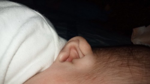 Deform ear