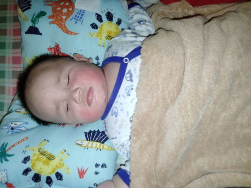 ดูแลเรื่องผดผื่นยังไงคะ