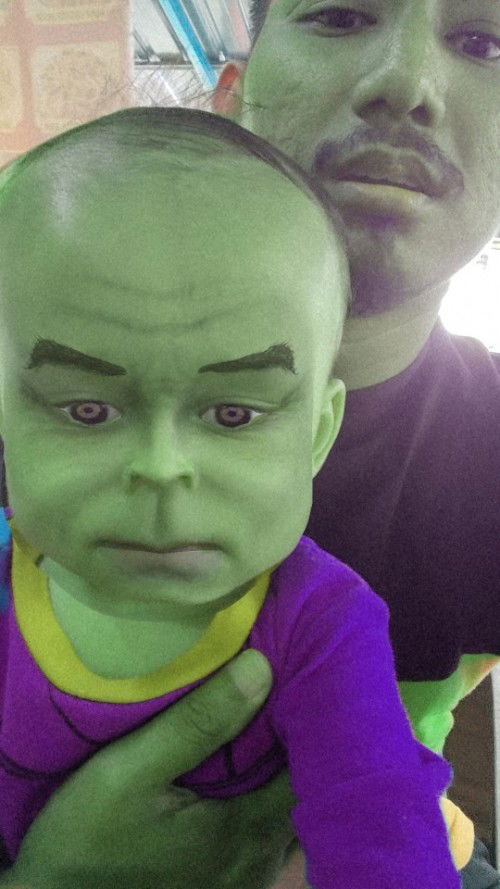 Baby 11 Bulan suka garu kepala ke????