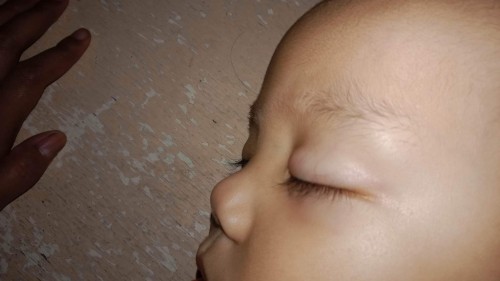 Mga mommies pahelp Naman po ano po kaya tong tumubo sa may mata nya maraming salamat po