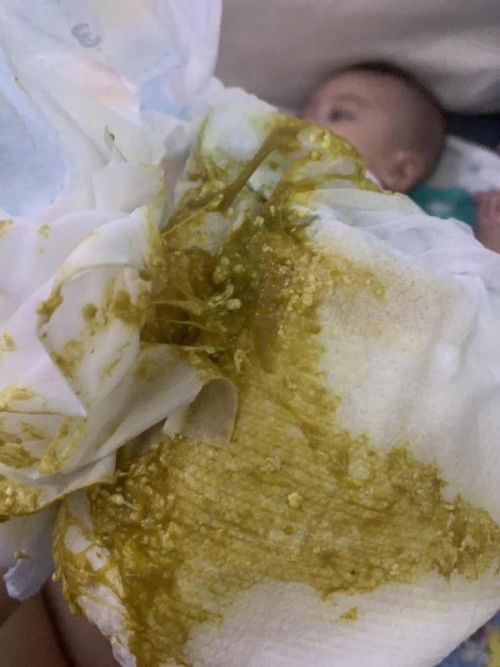 poop ng 6months old baby