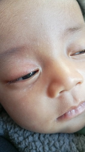 Bunda mau tanya dong anak aku mukanya ad bercak"putihh gini knpa ada yg sama gak? Bantu sharing ya b