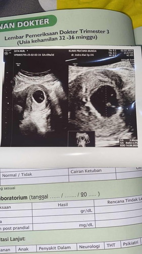 Bunda ijin sharing ada yang sama ga usg usia 9 week blm kelihatan janin? Bagi tips donk mom?