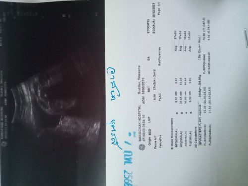 ตั้งครรภ์กี่วิก