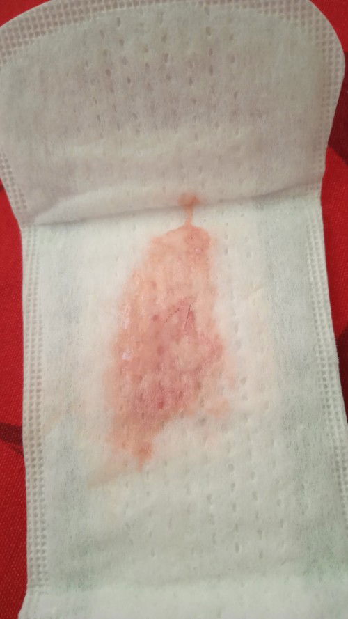 38w1d keluar lendir darah