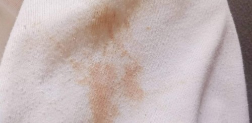 brown discharge