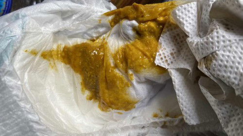 Fm + Df normal tak najis mcmni? Baby 2minggu lg nak masuk 2bulan.