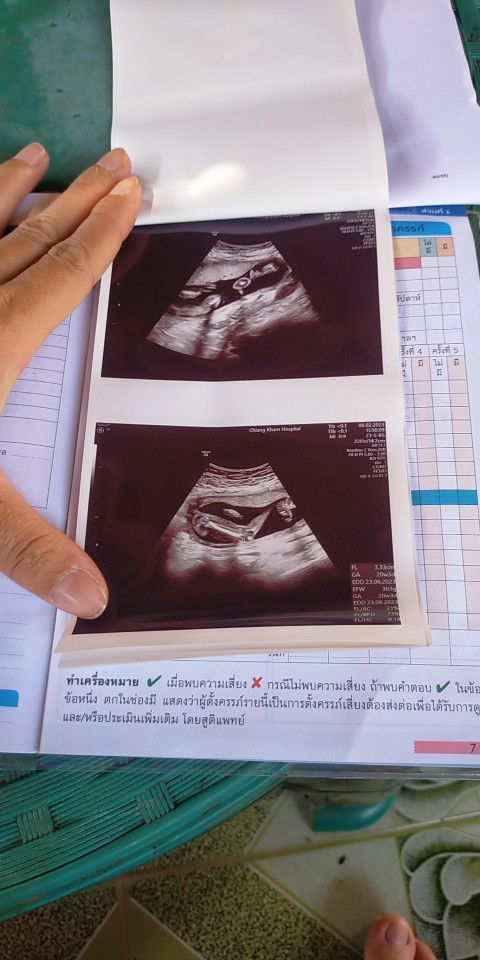 เมื่อวานไปหาหมอ