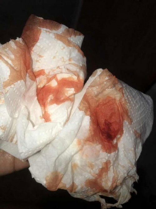 กำหนดคลอด13กุมภาพันธ์66