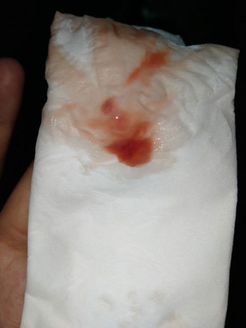 Lendir campur darah 39w4d