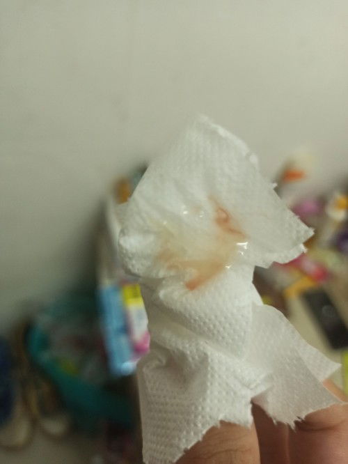 Mucus plug na po ba ito?