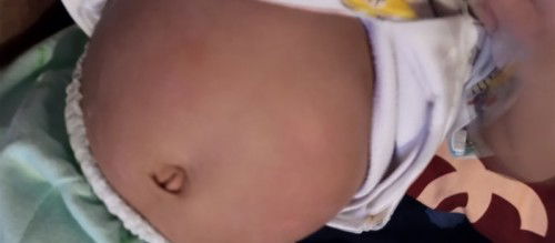 Seperti kurap warna putih kasar