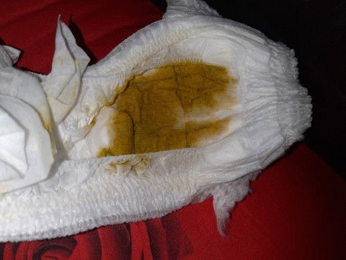 Pup bayi tidak berbentuk