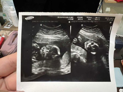 บันทึกเจ้าตัวเล็กในท้องแม่ 👼🏻