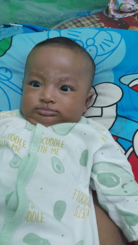 Bun,anakku di dahinya ada putih2 udh sbulan kira2 mesti berobat atau gmn y?
