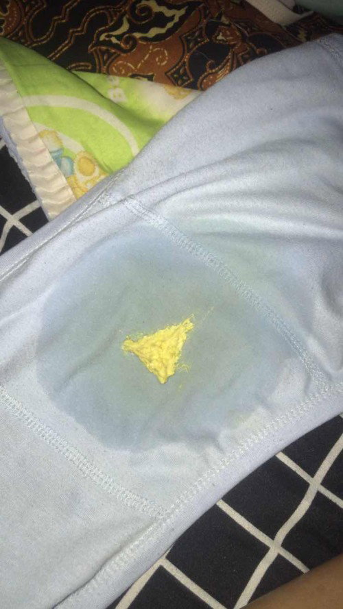 Apakah diare atau bukan?